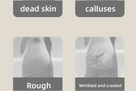 ფეხის ელექტრული სახეხი Callus Dead Skin Remover US